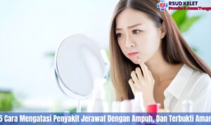 5 Cara Mengatasi Jerawat Dengan Ampuh, Dan Terbukti Aman