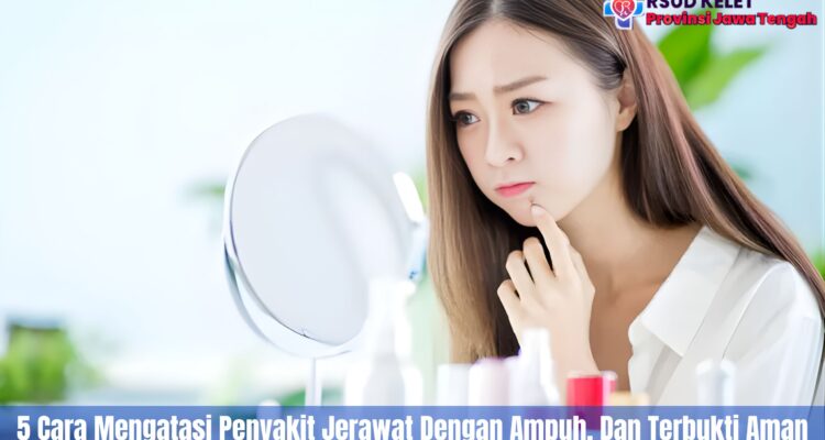 5 Cara Mengatasi Jerawat Dengan Ampuh, Dan Terbukti Aman