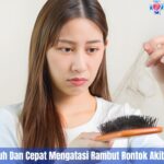 5 Cara Ampuh Dan Cepat Mengatasi Rambut Rontok Akibat Ketombe