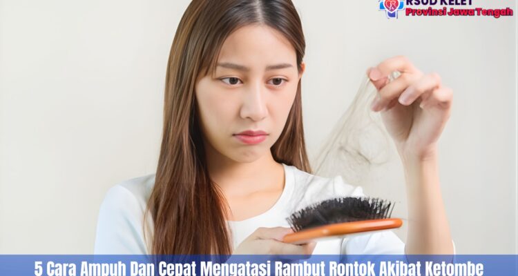 5 Cara Ampuh Dan Cepat Mengatasi Rambut Rontok Akibat Ketombe