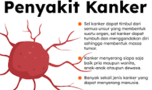 Cara Mengatasi Penyakit Kanker, Dan Penyebabnya
