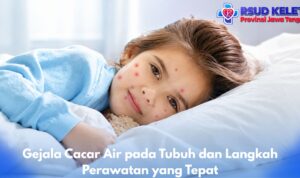 Gejala Cacar Air pada Tubuh dan Langkah Perawatan yang Tepat