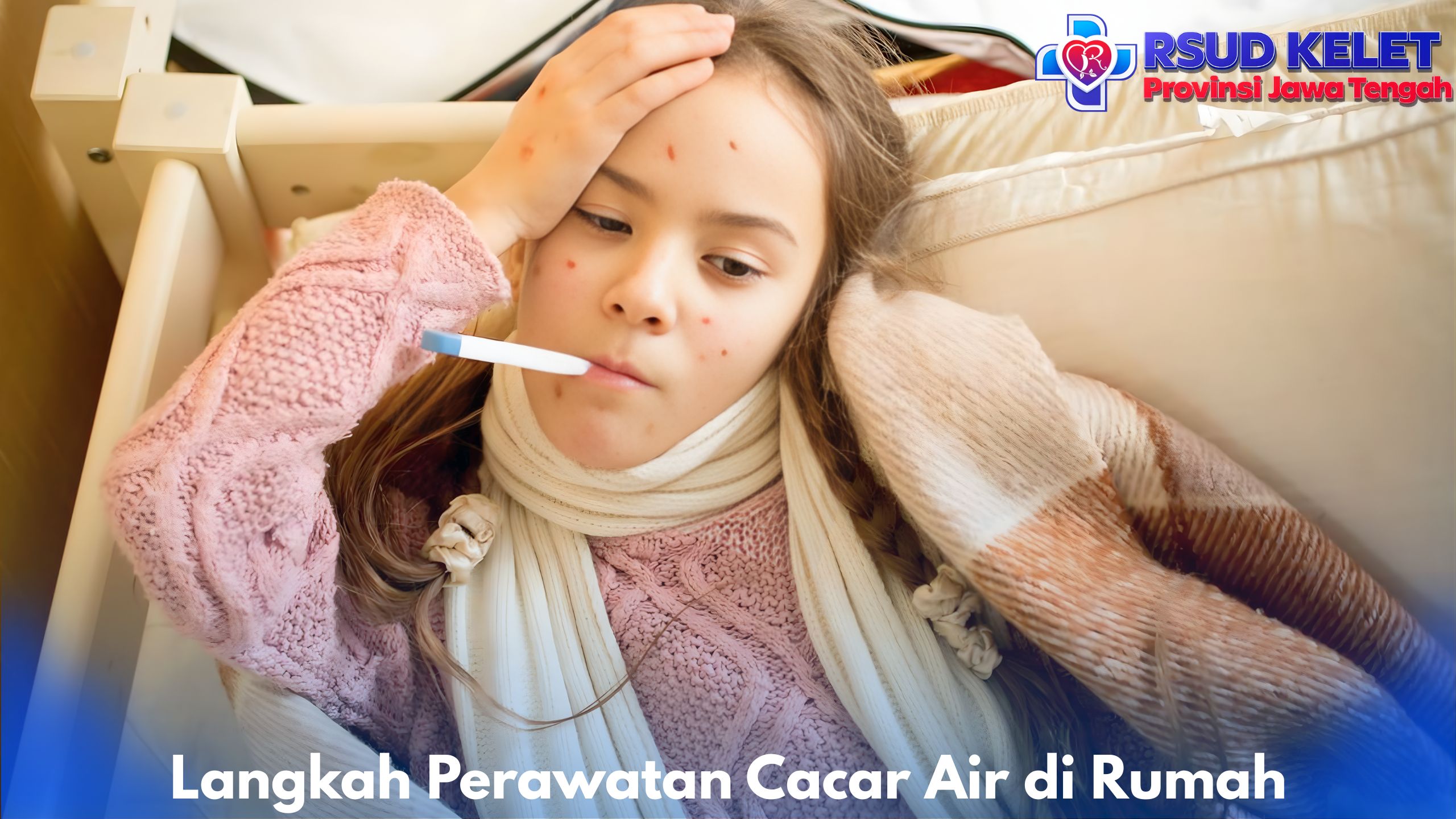 Langkah Perawatan Cacar Air di Rumah