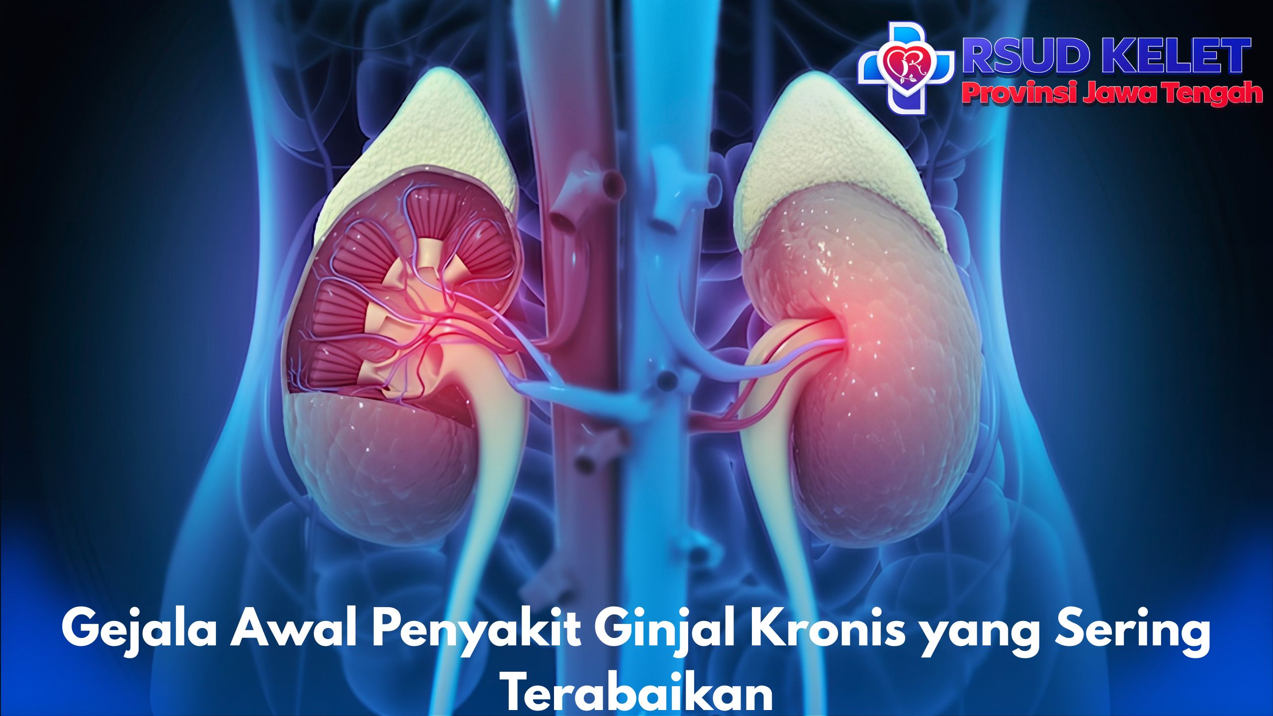 Gejala Awal Penyakit Ginjal Kronis yang Sering Terabaikan