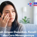 Mata Merah Jangan Diabaikan, Kenali Penyebab dan Cara Menanganinya