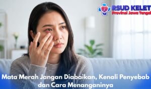 Mata Merah Jangan Diabaikan, Kenali Penyebab dan Cara Menanganinya