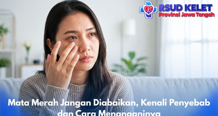 Mata Merah Jangan Diabaikan, Kenali Penyebab dan Cara Menanganinya