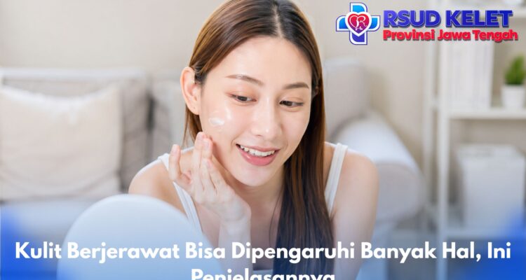 Kulit Berjerawat Bisa Dipengaruhi Banyak Hal, Ini Penjelasannya