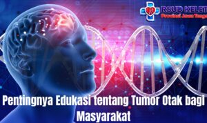 Pentingnya Edukasi tentang Tumor Otak bagi Masyarakat