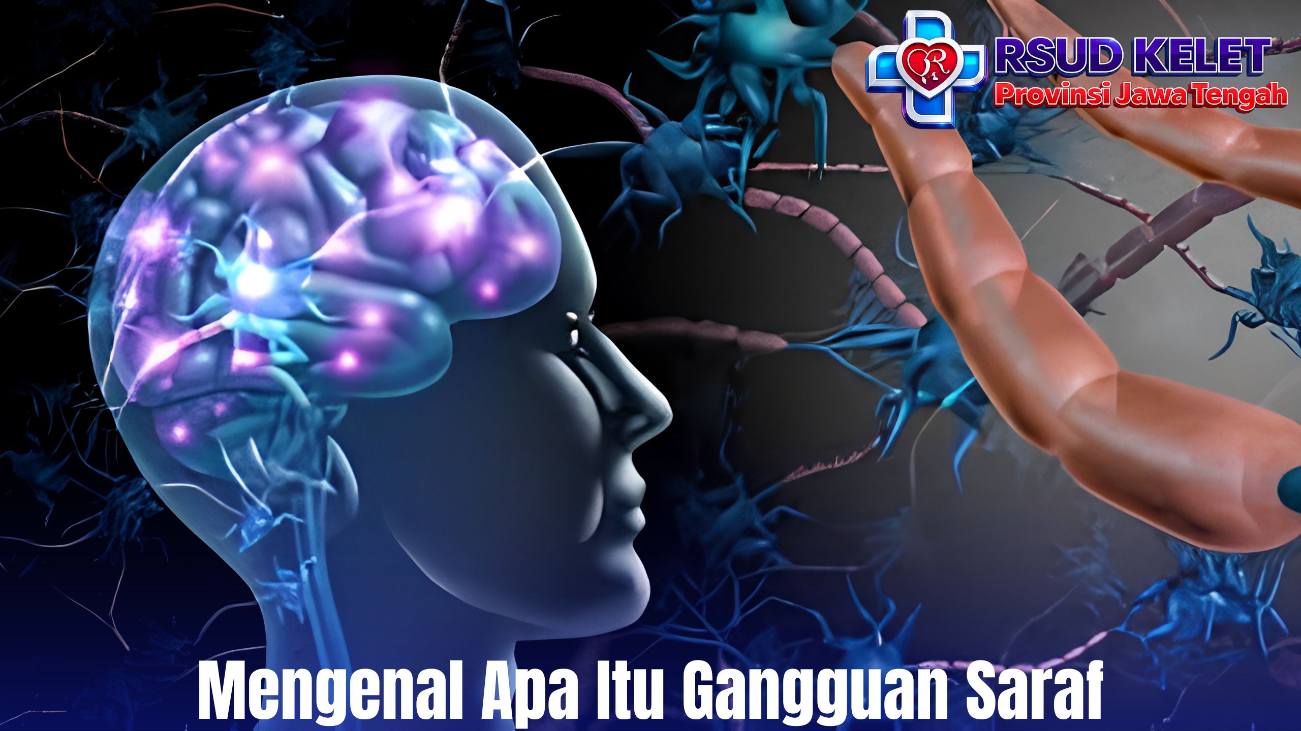 Mengenal Apa Itu Gangguan Saraf