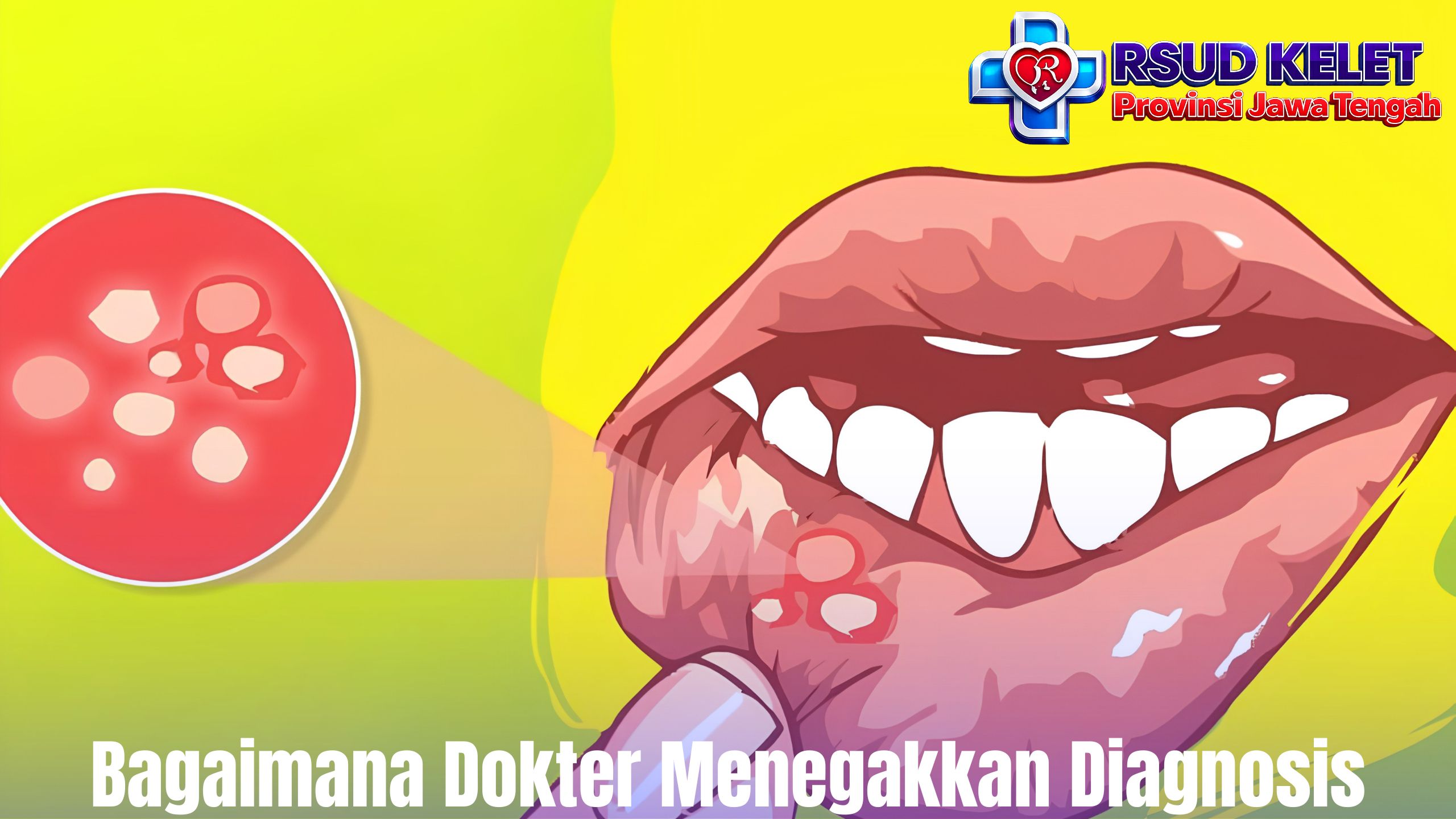 Bagaimana Dokter Menegakkan Diagnosis