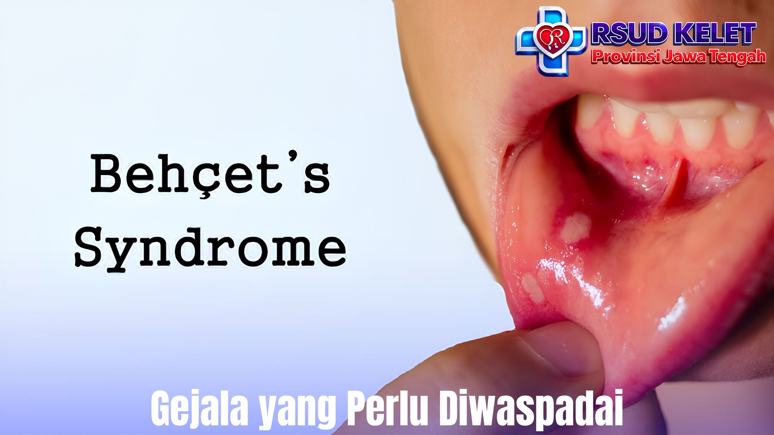 Gejala yang Perlu Diwaspadai