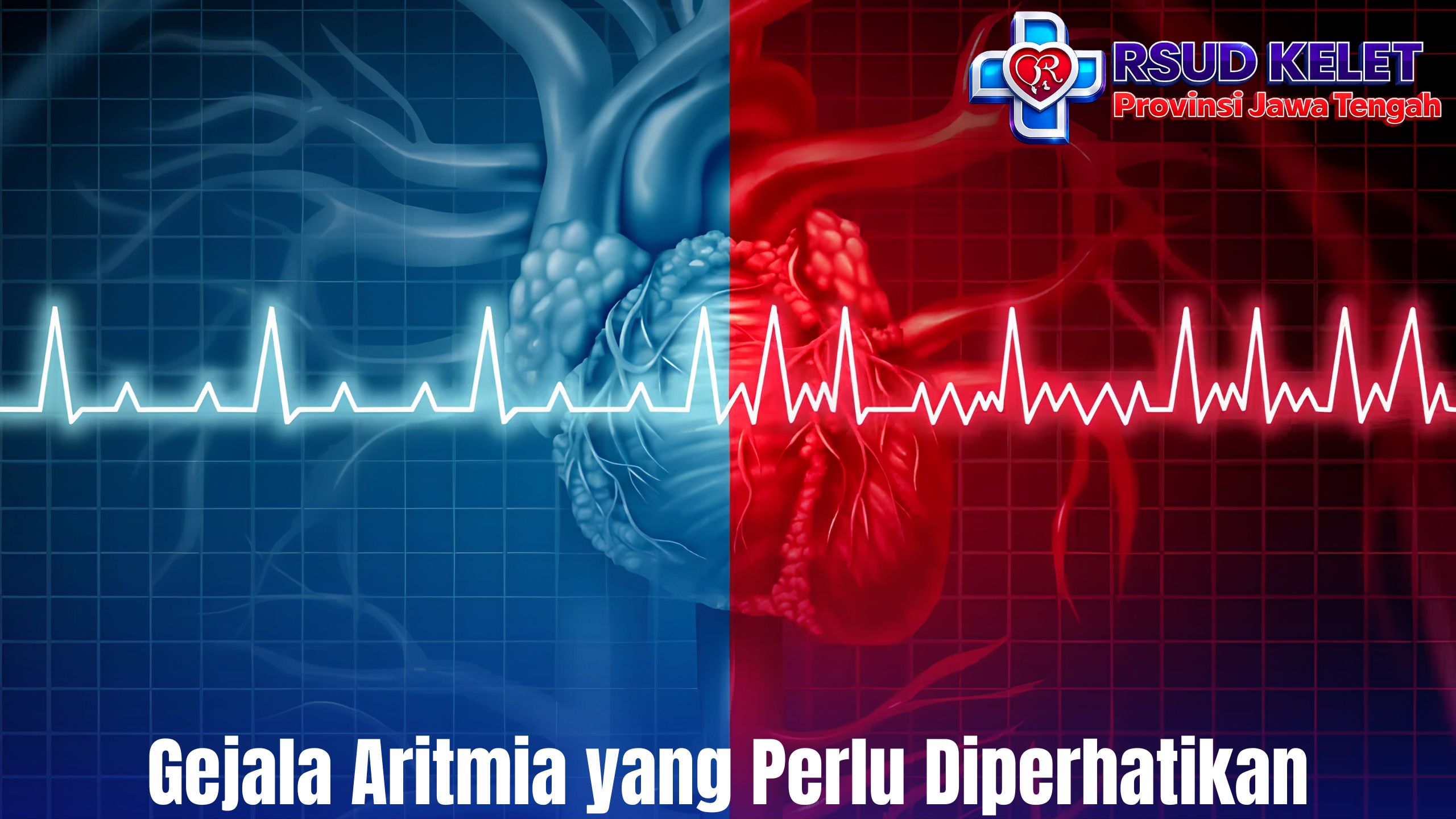 Gejala Aritmia yang Perlu Diperhatikan