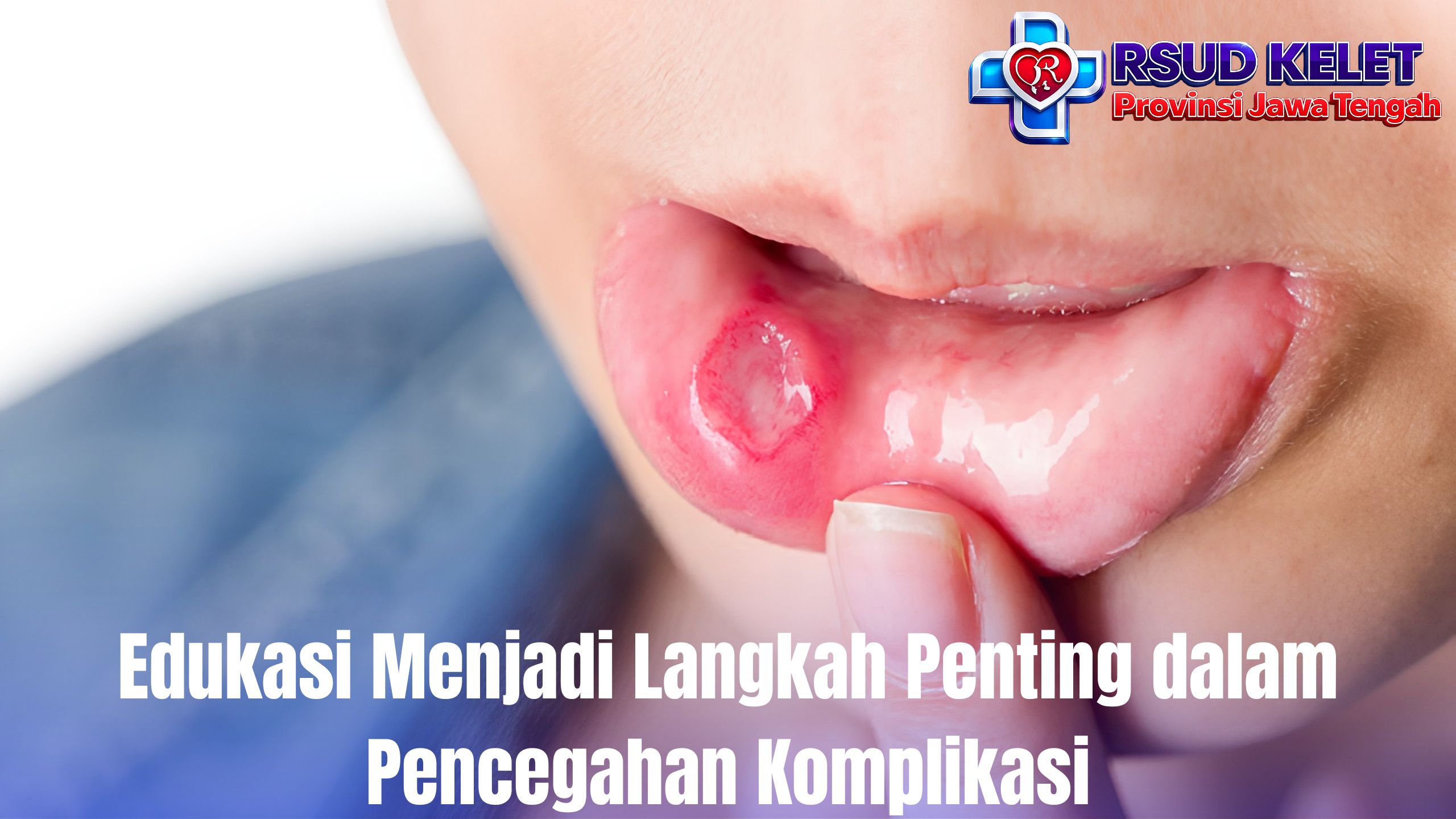 Edukasi Menjadi Langkah Penting dalam Pencegahan Komplikasi