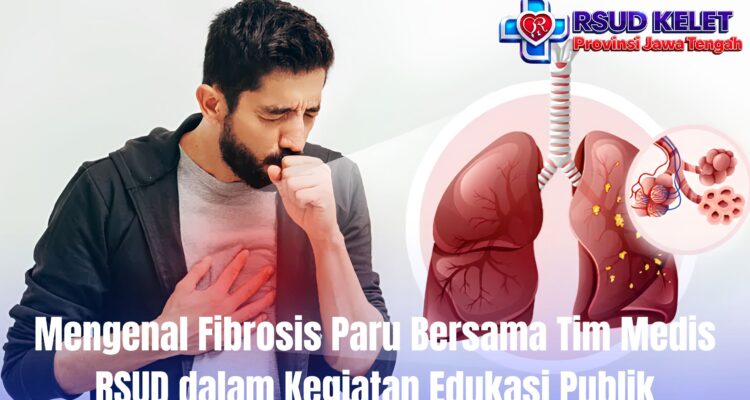 Mengenal Fibrosis Paru Bersama Tim Medis RSUD dalam Kegiatan Edukasi Publik