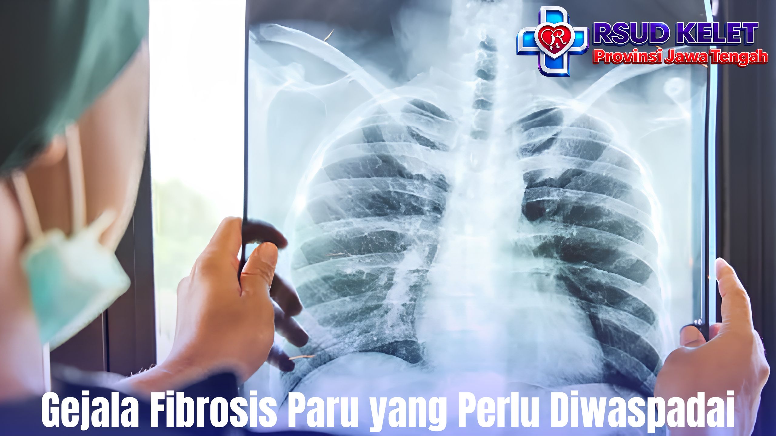 Gejala Fibrosis Paru yang Perlu Diwaspadai