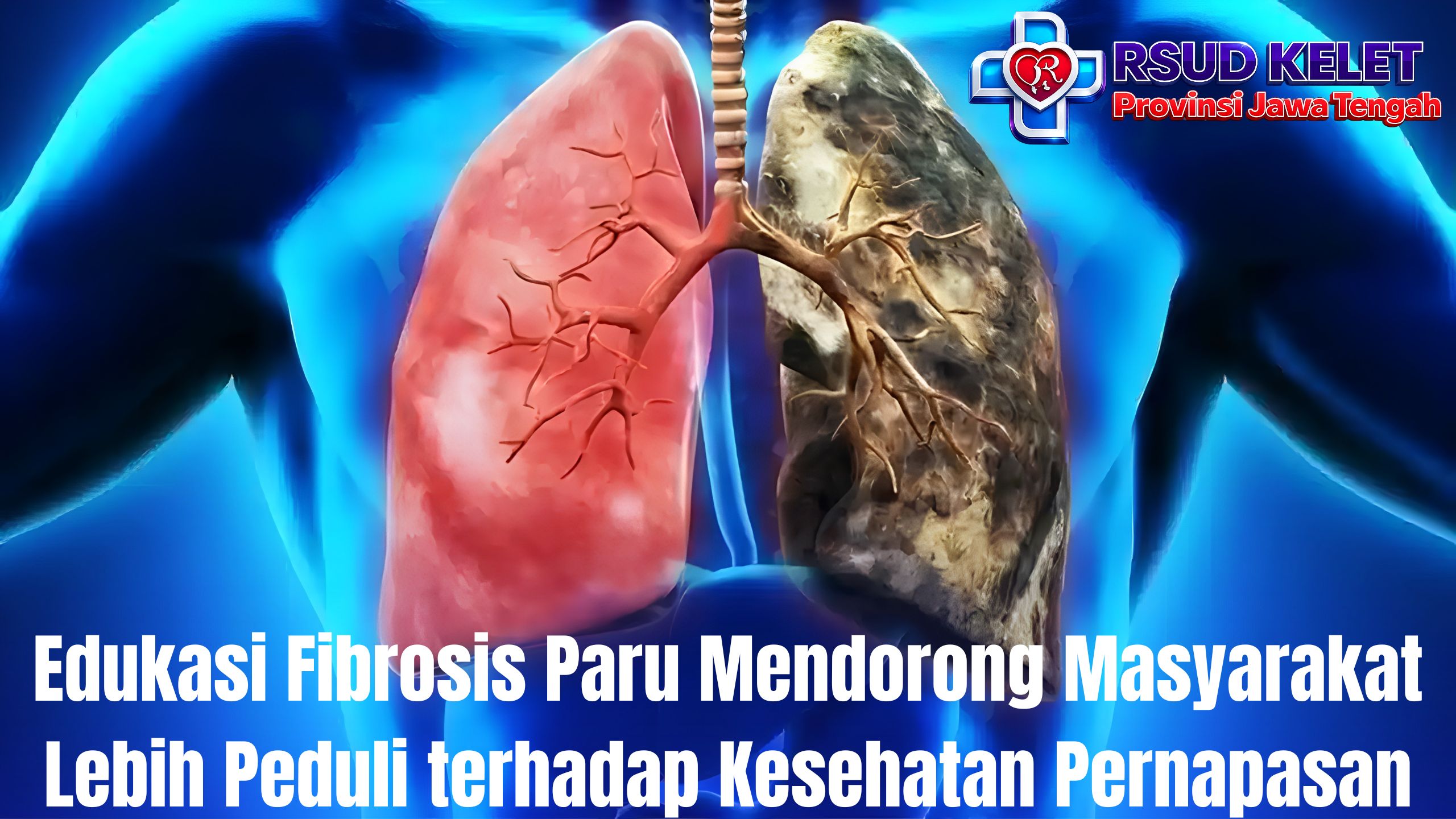 Edukasi Fibrosis Paru Mendorong Masyarakat Lebih Peduli terhadap Kesehatan Pernapasan
