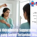 Waspadai Hidradenitis Suppurativa, Penyakit Kulit yang Sering Terlambat Disadari