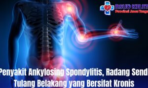 Penyakit Ankylosing Spondylitis, Radang Sendi Tulang Belakang yang Bersifat Kronis