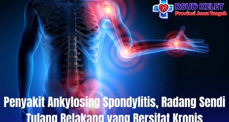 Penyakit Ankylosing Spondylitis, Radang Sendi Tulang Belakang yang Bersifat Kronis