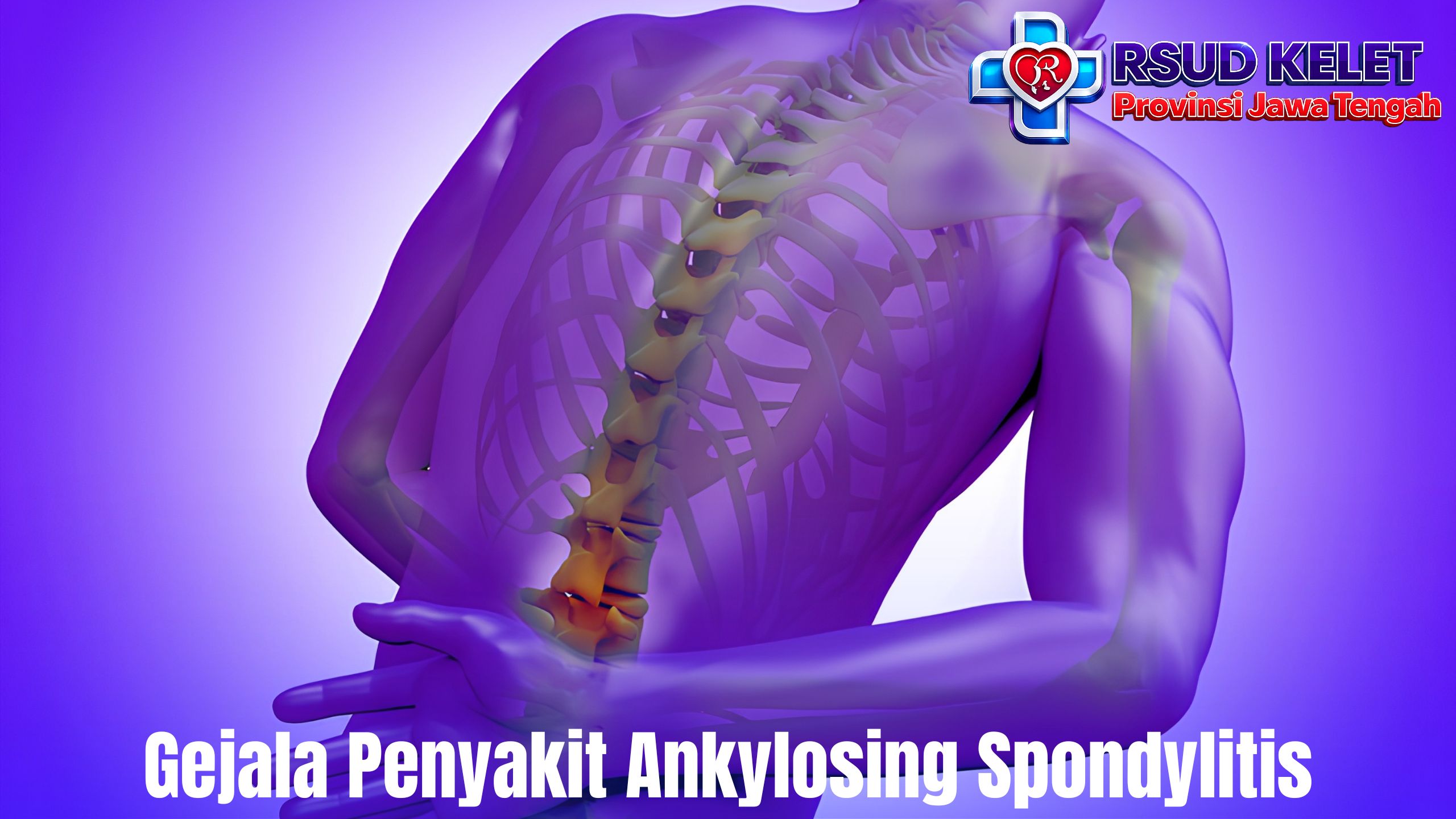 Gejala Penyakit Ankylosing Spondylitis
