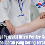 Mengenal Penyakit Arteri Perifer: Gangguan Sirkulasi Darah yang Sering Terabaikan