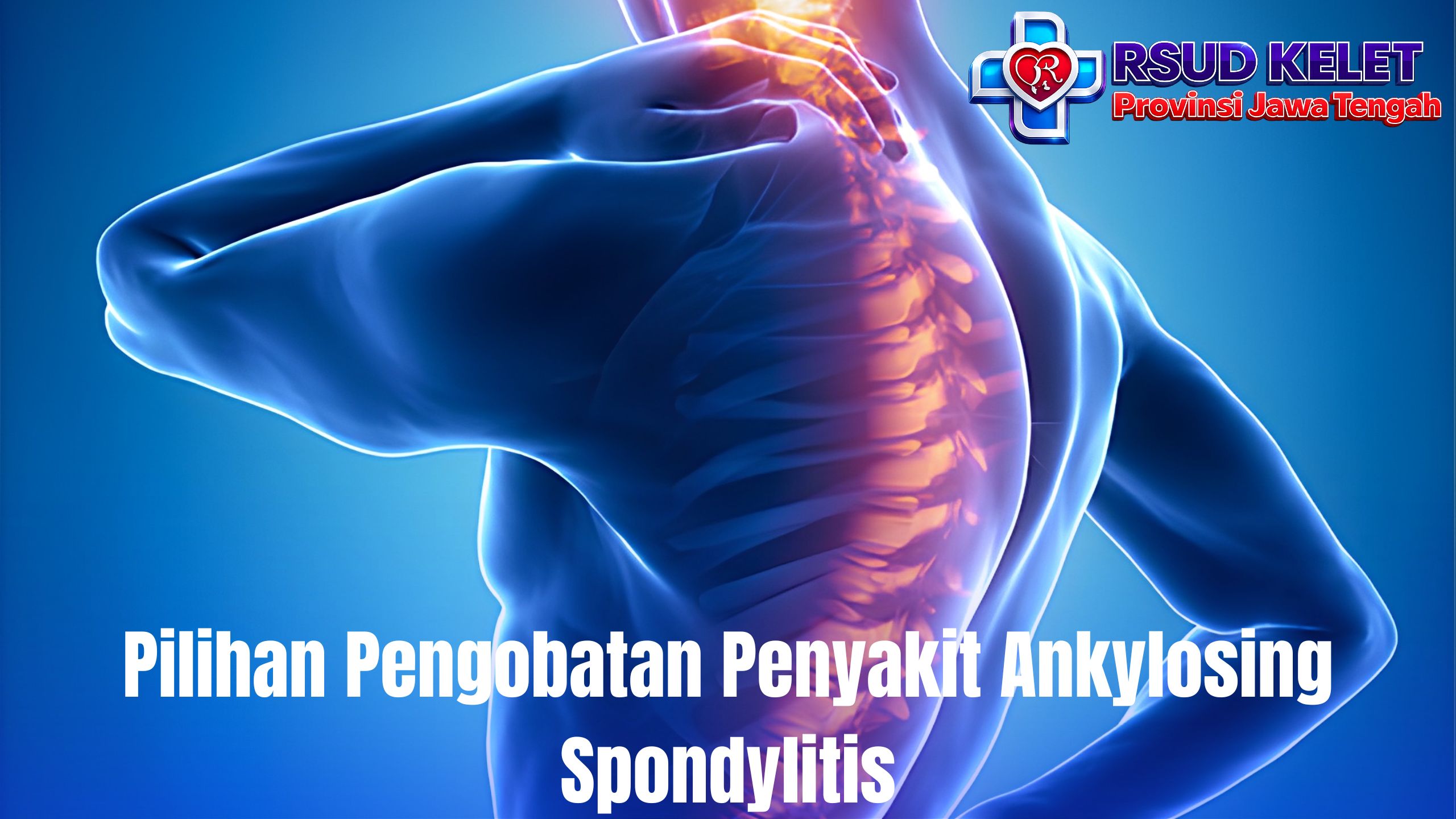 Pilihan Pengobatan Penyakit Ankylosing Spondylitis