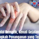 Waspadai Rematik, Kenali Gejalanya dan Langkah Penanganan yang Tepat