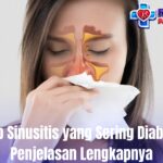 Penyebab Sinusitis yang Sering Diabaikan, Ini Penjelasan Lengkapnya