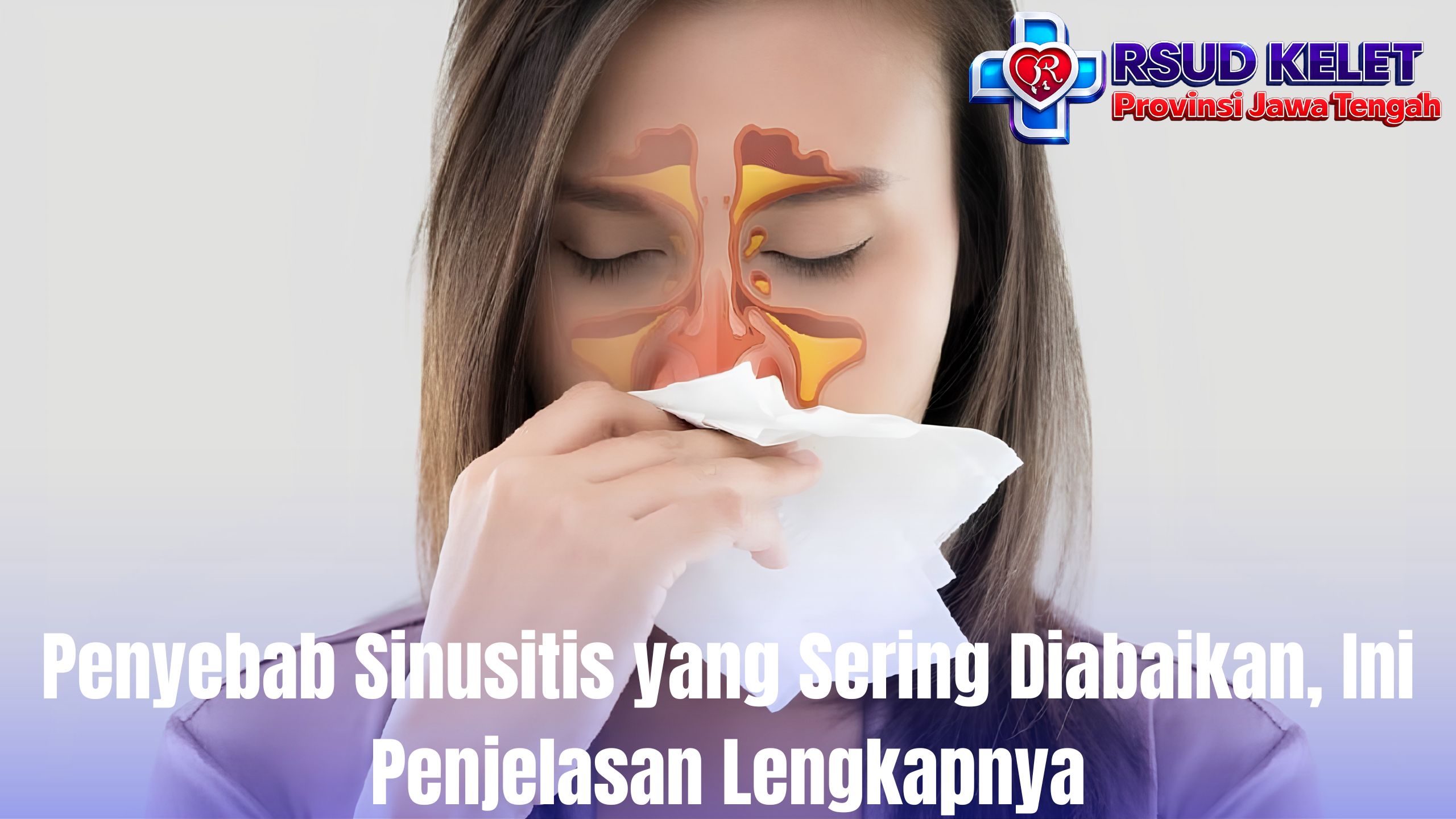 Penyebab Sinusitis yang Sering Diabaikan, Ini Penjelasan Lengkapnya