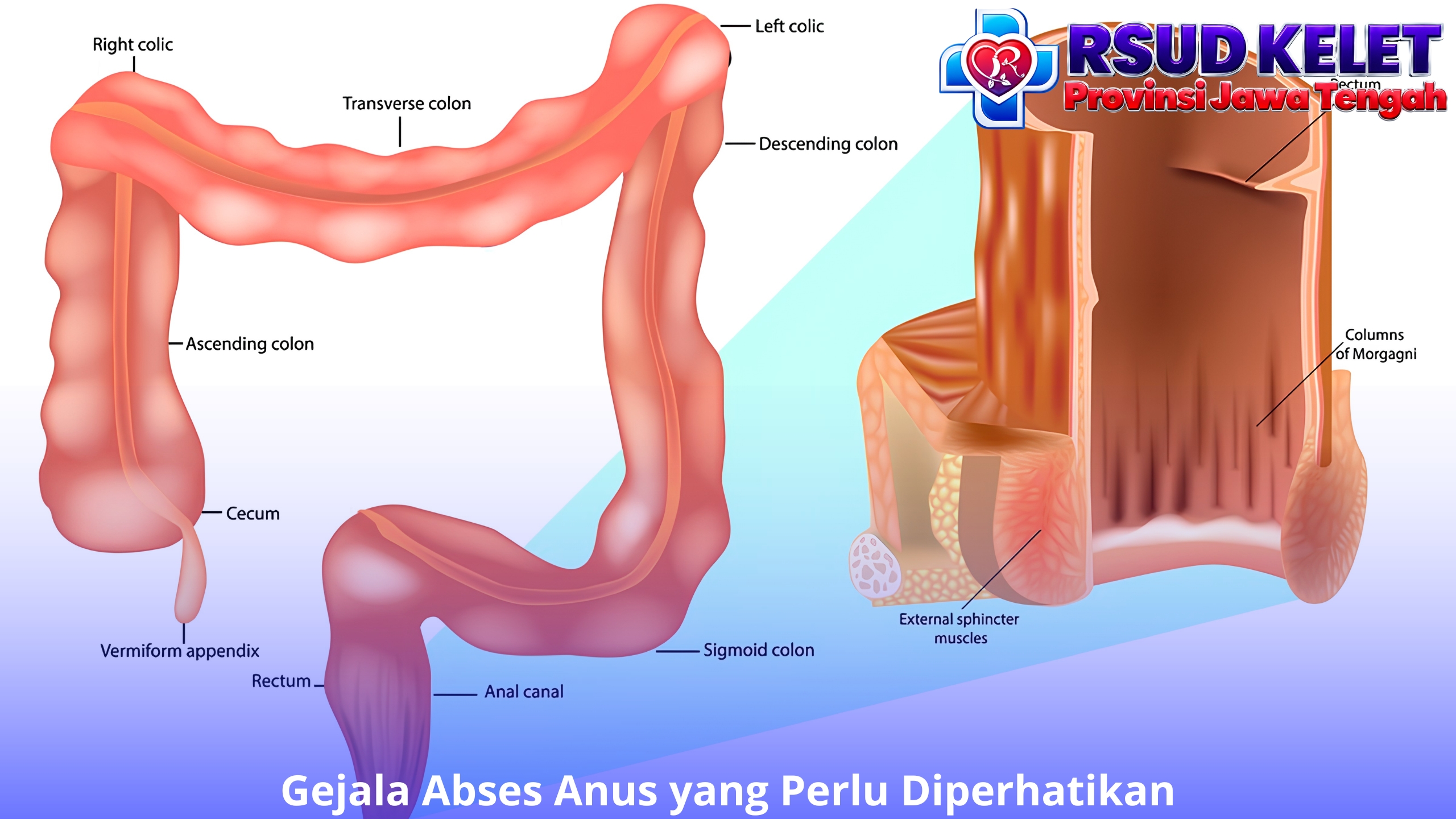 Gejala Abses Anus yang Perlu Diperhatikan