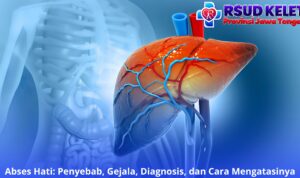 Abses Hati: Penyebab, Gejala, Diagnosis, dan Cara Mengatasinya