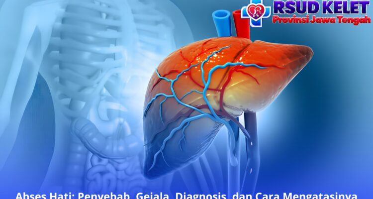 Abses Hati: Penyebab, Gejala, Diagnosis, dan Cara Mengatasinya