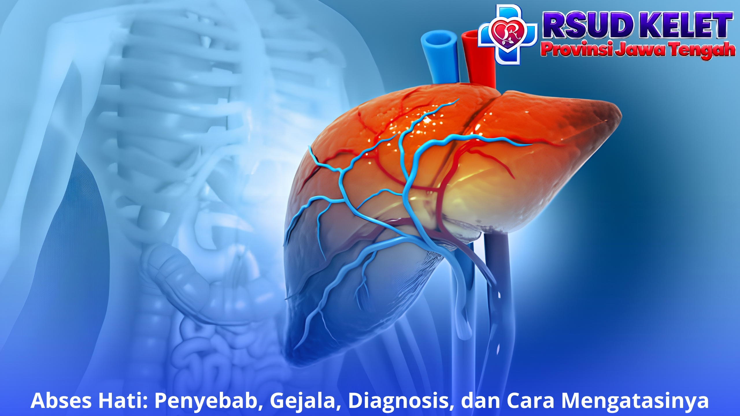 Abses Hati: Penyebab, Gejala, Diagnosis, dan Cara Mengatasinya