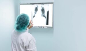 Abses Paru Tak Boleh Disepelekan, Ini Gejala yang Sering Muncul