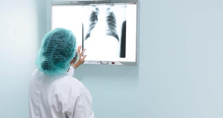 Abses Paru Tak Boleh Disepelekan, Ini Gejala yang Sering Muncul