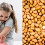 Mengenal Alergi Kacang, dari Penyebab hingga Gejala yang Perlu Diwaspadai Mengenal Alergi Kacang, dari Penyebab hingga Gejala yang Perlu Diwaspadai