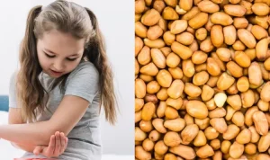 Mengenal Alergi Kacang, dari Penyebab hingga Gejala yang Perlu Diwaspadai Mengenal Alergi Kacang, dari Penyebab hingga Gejala yang Perlu Diwaspadai