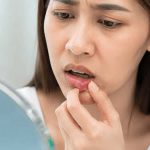 Aktinomikosis Bukan Penyakit Menular, tetapi Tetap Perlu Ditangani