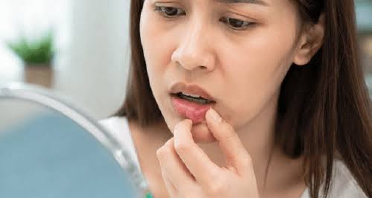 Aktinomikosis Bukan Penyakit Menular, tetapi Tetap Perlu Ditangani